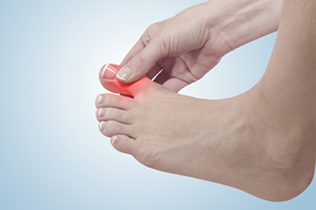 Easing Big Toe Joint Arthritis Without Surgery