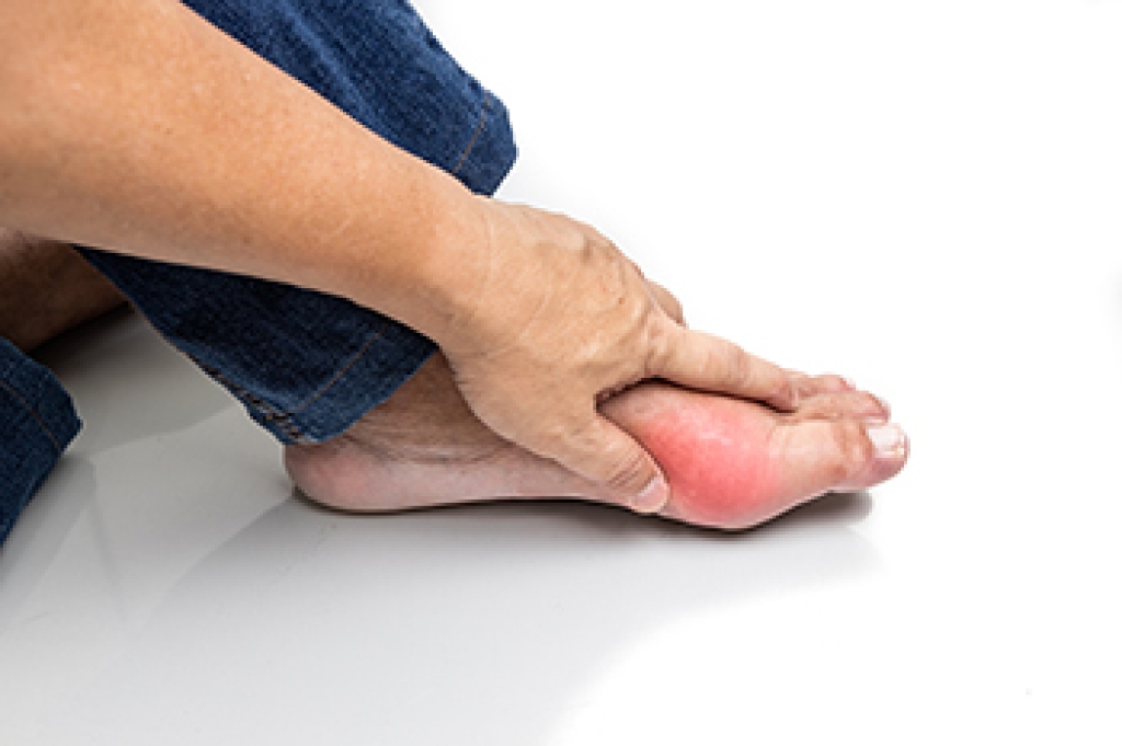 Sudden Pain From Gout